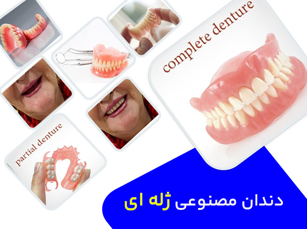 دندان مصنوعی ژله ای