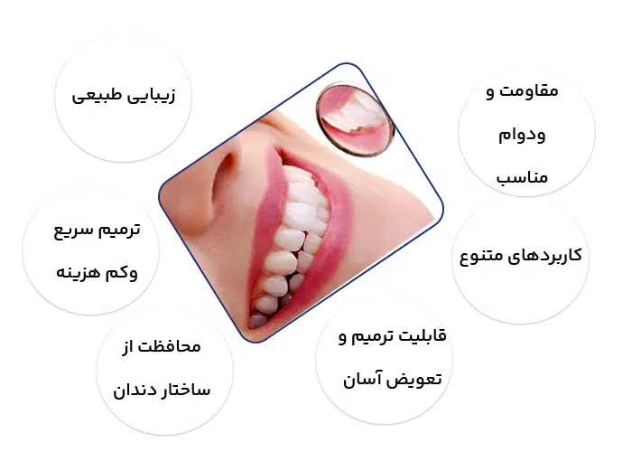 کامپوزیت دندان