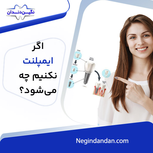 اگرایمپلنت نکنیم چه میشود؟