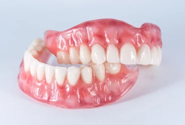 هزینه پروتز دندان ایوکلار ایتالیایی (Ivoclar Italy)