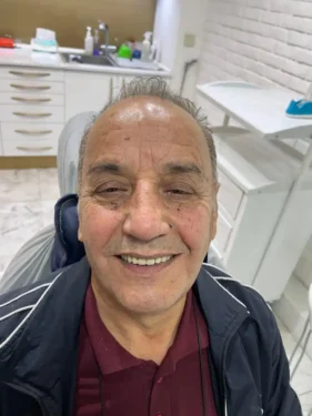 دندان مصنوعی لهستانی بر طبق رنگ دندان و صورت بیمار