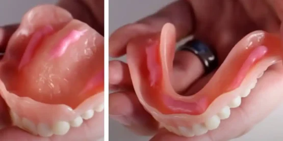 دندان مصنوعی ژله ای برای چه کسانی مناسب است؟