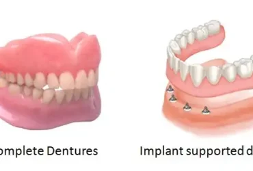 دندان مصنوعی ثابت بهتر است یا پروتز متحرک؟