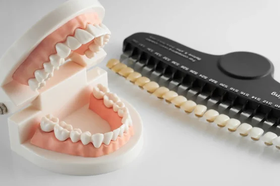 دنچر (denture) | دندان مصنوعی | پروتز دندان چیست؟
