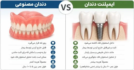 تفاوت دندان مصنوعی و ایمپلنت
