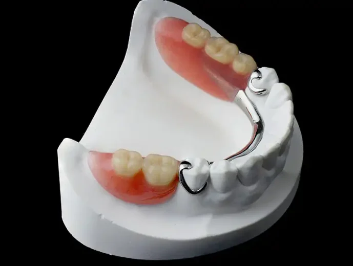 قیمت پروتز پارسیل چقدر است؟

